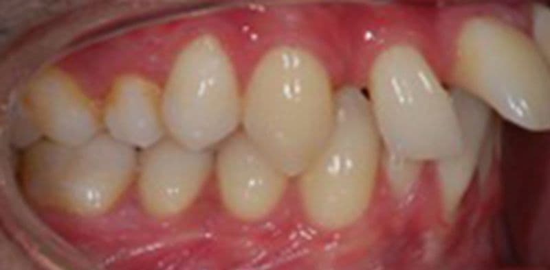 Amy - before treatment