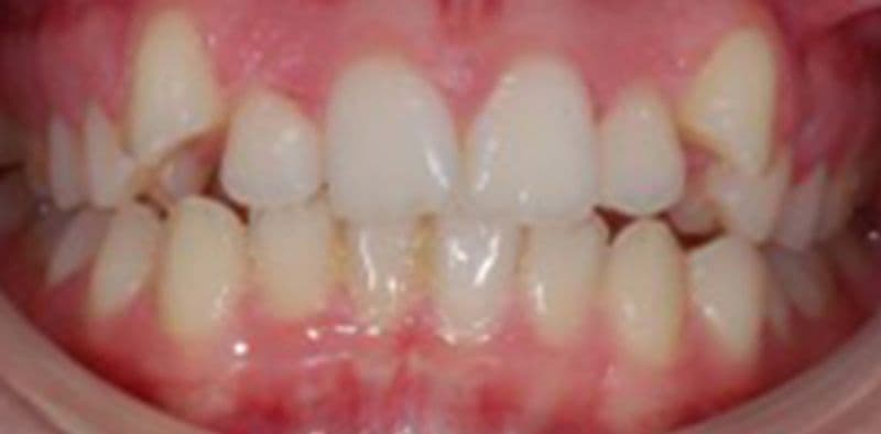 Kathryn - after treatment