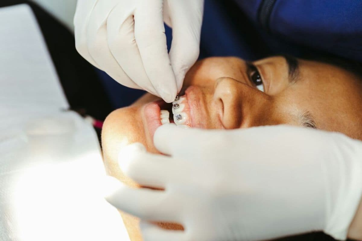 Orthodontic treatment in progress