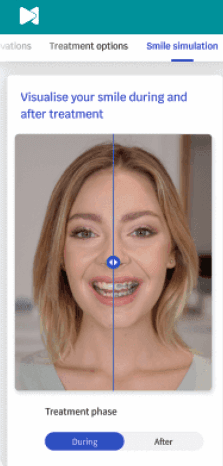 A phone with the dental monitoring app open showing a patient with braces