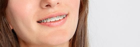 Braces for Under 18s